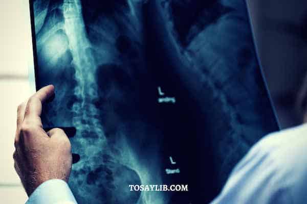 doctor check xray surgeon