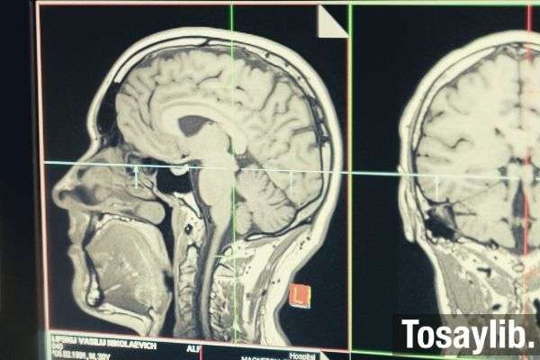 3d scanning ct scan photo monitor skull head