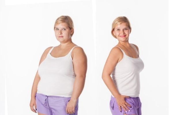 before after weight loss rejuvenation fat